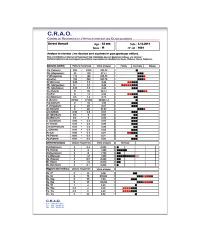 Analyse cheveux Laboratoire Bioligo